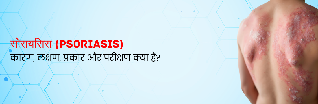 सोरायसिस: इसके कारण, लक्षण, प्रकार और परीक्षण क्या हैं?